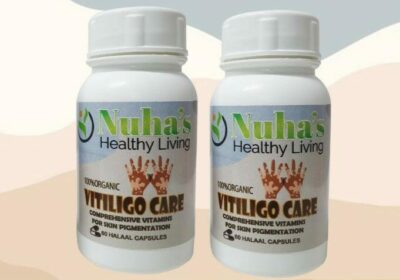Vitiligo-Care-e1626614419201